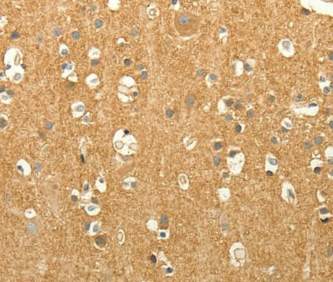 Anti-Human/Mouse/Rat EDG7 Antibody - ABMIUM