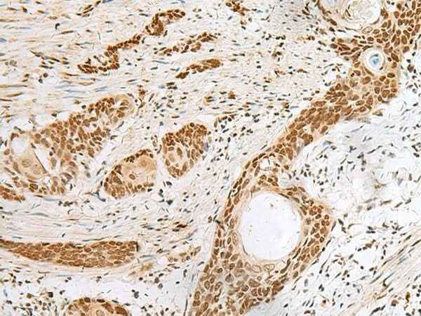 Anti-Human/Mouse/Rat PNRC2 Antibody