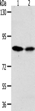 Anti-Human/Mouse ADAM11 Antibody - ABMIUM