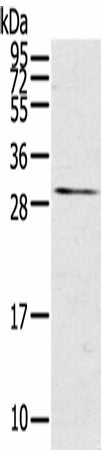 Anti-Human/Mouse/Rat TNFSF15 Antibody - ABMIUM