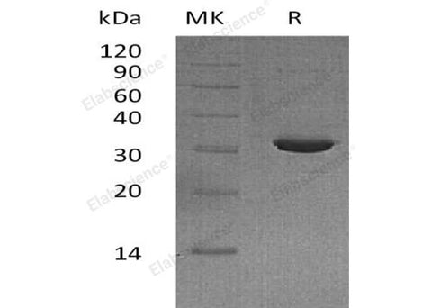 Recombinant Human IMPA2/IMPase 2 Protein (His Tag) - ABMIUM