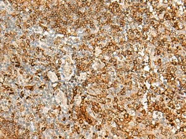 Anti-Human HLA-DRB1 Antibody