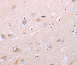 Anti-Human/Mouse/Rat ADCY5 Antibody - ABMIUM