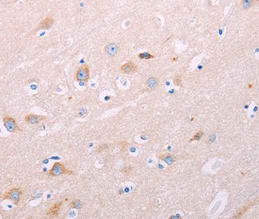 Anti-Human/Mouse/Rat ADCY5 Antibody