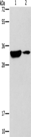 Anti-Human/Mouse DSCR1 Antibody - ABMIUM