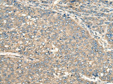 Anti-Human/Mouse/Rat PIAS3 Antibody - ABMIUM