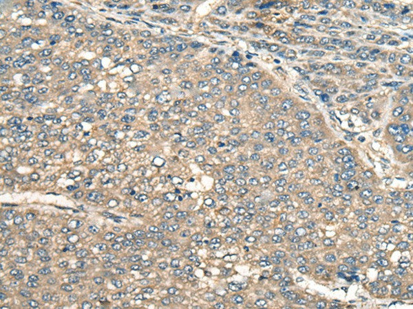Anti-Human/Mouse/Rat PIAS3 Antibody - ABMIUM