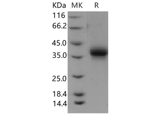 > 97 % as determined by reducing SDS-PAGE.
