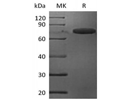 Recombinant Mouse Leukocyte Ig-Like Receptor B4/LILRB4/CD85k/ILT3 (C-Fc) - ABMIUM