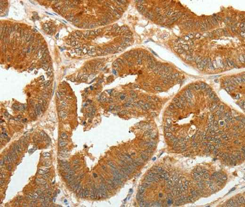 Anti-Human/Mouse/Rat ASCL1 Antibody