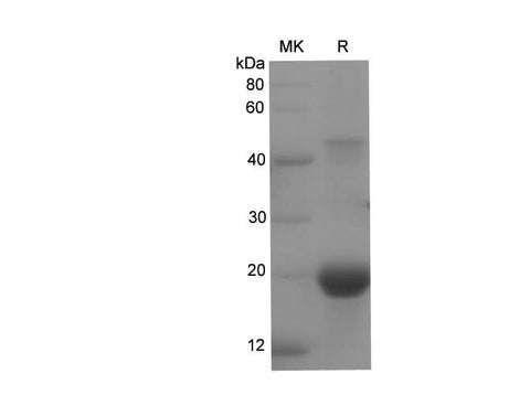 SDS-PAGE analysis of Rat AMPK alpha2 proteins, 2 μg/lane of Recombinant Rat AMPK alpha2 proteins was resolved with SDS-PAGE under reducing conditions, showing bands at 22.3 kDa.