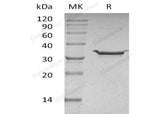 Recombinant Human Carbonic Anhydrase 5B/CA5B Protein (His Tag) - ABMIUM