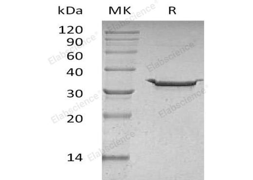 Recombinant Human Carbonic Anhydrase 5B/CA5B Protein (His Tag) - ABMIUM