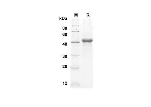 SDS-PAGE analysis of Human sCD40L proteins, 2 μg/lane of Recombinant Human sCD40L proteins was resolved with an SDS-PAGE under reducing conditions, showing bands at 41.2 kDa.