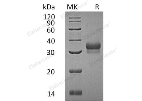 Recombinant Human Ephrin-B1/EFNB1 Protein (His Tag) - ABMIUM