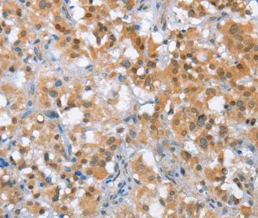 Anti-Human/Mouse/Rat MLH1 Antibody