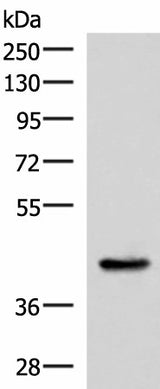 Western blot analysis of Mouse liver tissue lysate using HPN Polyclonal Antibody at dilution of 1:550