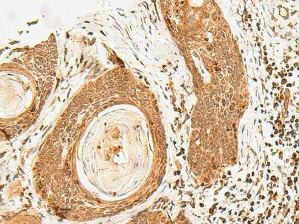 Anti-Human/Mouse POLH Antibody