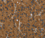 Anti-Human/Mouse MIER2 Antibody - ABMIUM