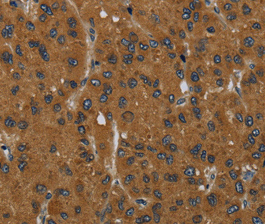 Anti-Human/Mouse MIER2 Antibody - ABMIUM