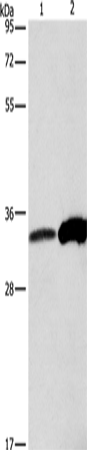 Anti-Human/Mouse/Rat ANXA4 Antibody - ABMIUM