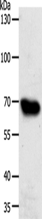 Anti-Human ABCG1 Antibody - ABMIUM