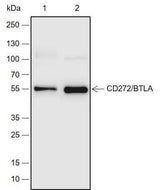 Anti-Human/Mouse CD272/BTLA Antibody [A693]