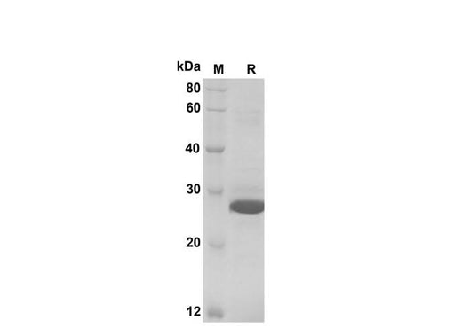 SDS-PAGE analysis of Human CCL27/CTACK proteins, 2 μg/lane of Recombinant Human CCL27/CTACK proteins was resolved with SDS-PAGE under reducing conditions, showing bands at 28 kDa.