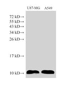 Anti-Human S100A6 Antibody - ABMIUM