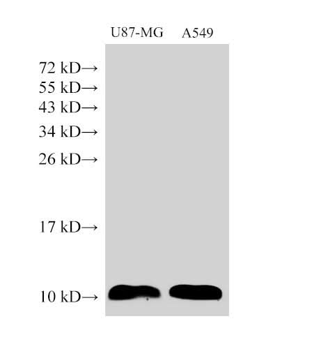 Anti-Human S100A6 Antibody - ABMIUM
