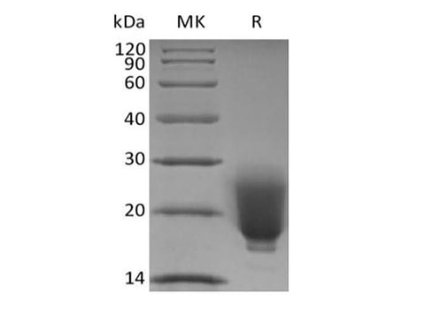Recombinant Human/Mouse/Rat Irisin/FNDC5 (N-6His) - ABMIUM