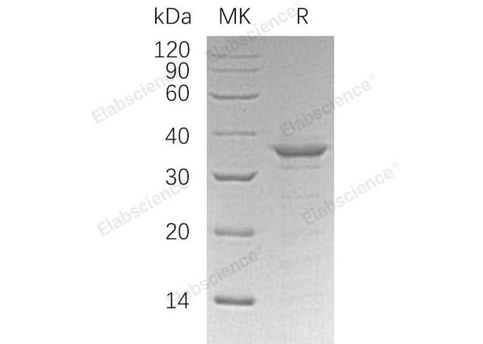 Recombinant Human ETS1/EWSR2 Protein (His Tag) - ABMIUM