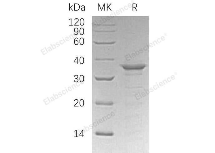 Recombinant Human ETS1/EWSR2 Protein (His Tag) - ABMIUM