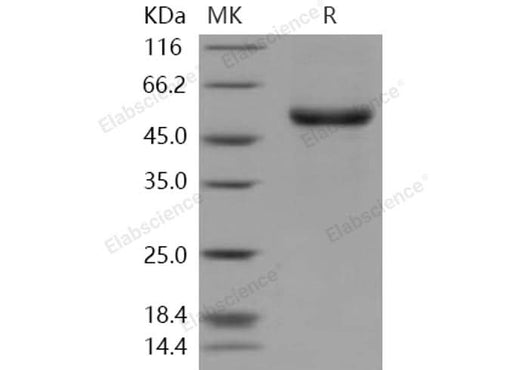 Recombinant Human EDAR/DL Protein (Fc Tag) - ABMIUM