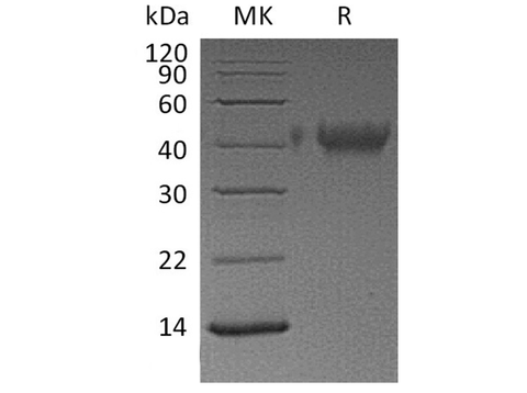 Recombinant Human TIM-3/HAVCR2 Protein (His Tag) - ABMIUM