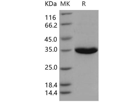 Recombinant Human PSA/KLK3 Protein (His Tag) - ABMIUM