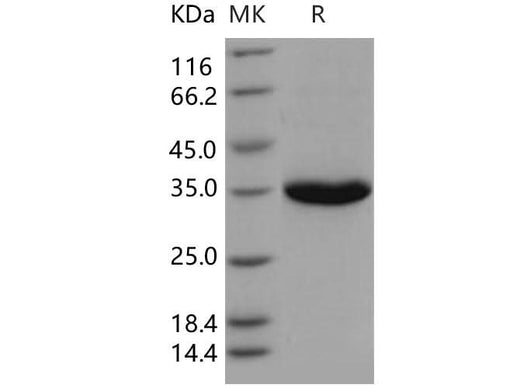 Recombinant Human PSA/KLK3 Protein (His Tag) - ABMIUM