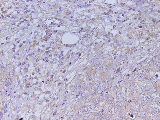 Anti-Human KLK2 Antibody - ABMIUM