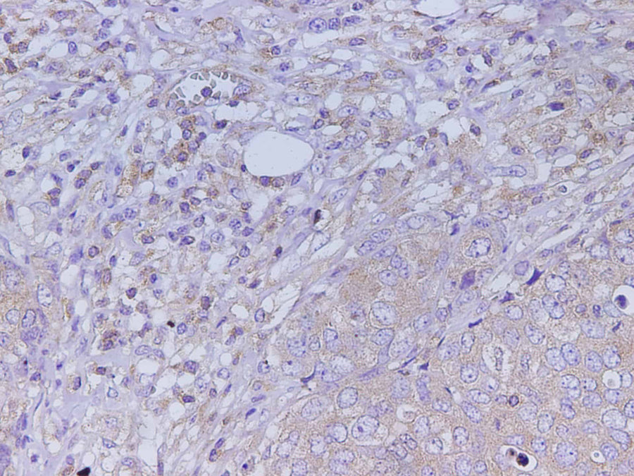 Anti-Human KLK2 Antibody - ABMIUM