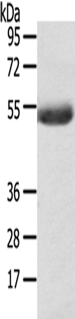 Anti-Human/Mouse AGPAT6 Antibody - ABMIUM