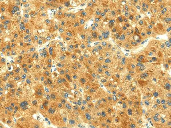 Anti-Human THAP3 Antibody - ABMIUM