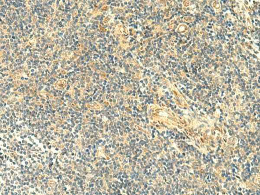 Anti-Human/Mouse ASB6 Antibody