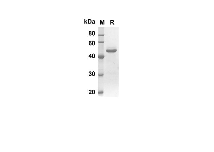SDS-PAGE analysis of Human STAR proteins, 2 μg/lane of Recombinant Human STAR proteins was resolved with SDS-PAGE under reducing conditions, showing bands at 44.2 kDa.