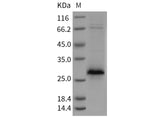 Recombinant Rat XEDAR/EDA2R Protein (His Tag) - ABMIUM