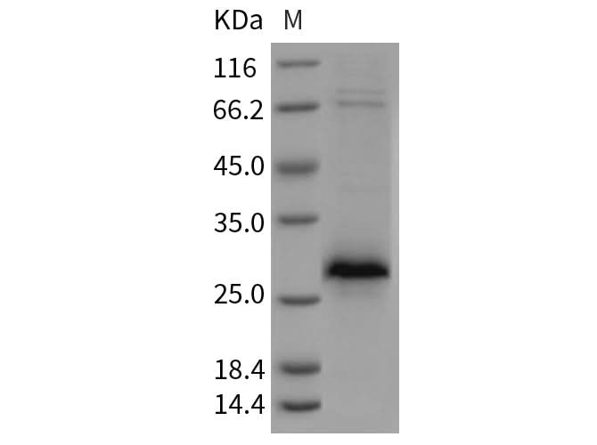 Recombinant Rat XEDAR/EDA2R Protein (His Tag) - ABMIUM