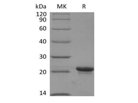 Recombinant Human KRAS4B(G12V, N-6His) - ABMIUM