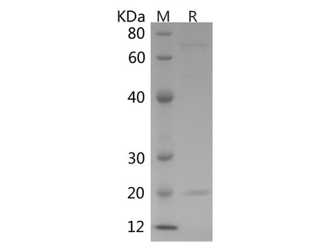 SDS-PAGE analysis of Human CTLA-4/CD152 proteins, 2 μg/lane of Recombinant Human CTLA-4/CD152 proteins was resolved with SDS-PAGE under reducing conditions, showing bands at 15 kDa.