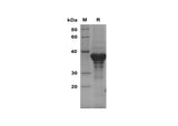 SDS-PAGE analysis of Human RPLP1 proteins, 2 μg/lane of Recombinant Human RPLP1 proteins was resolved with SDS-PAGE under reducing conditions, showing bands at 38 kDa.