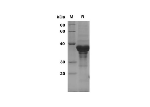 SDS-PAGE analysis of Human RPLP1 proteins, 2 μg/lane of Recombinant Human RPLP1 proteins was resolved with SDS-PAGE under reducing conditions, showing bands at 38 kDa.