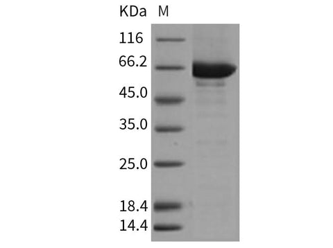Recombinant Mouse CSK/C-Src kinase Protein (His & GST Tag) - ABMIUM